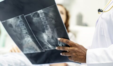 Recoverable Damages After a Spinal Cord Injury